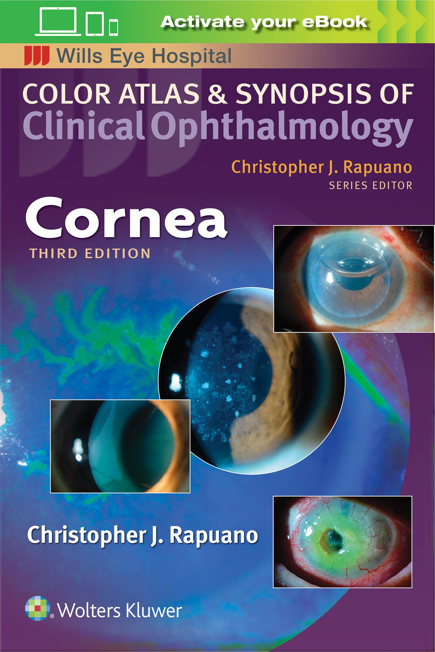Cornea (Color Atlas and Synopsis of Clinical Ophthalmology) / Christopher J. Rapuano / Taschenbuch / Kartoniert / Broschiert / Englisch / 2018 / Lippincott Williams&Wilki / EAN 9781496366818 - Rapuano, Christopher J.